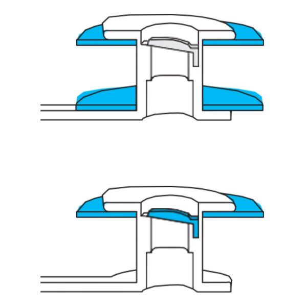 Large Esophageal and Tracheal Flanges